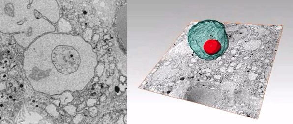 Serial block-face scanning electron microscopy（SBF-SEM）による甲状腺乳頭癌の核形態の解析